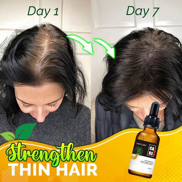 10X-Regro Strong Hair Serum