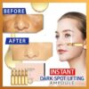 Instant Dark Spot Lifting Ampoule
