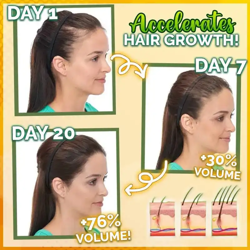 10X-Regro Strong Hair Serum - Billede 2