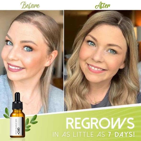 Gro+ Hair Activating Serum - Billede 3
