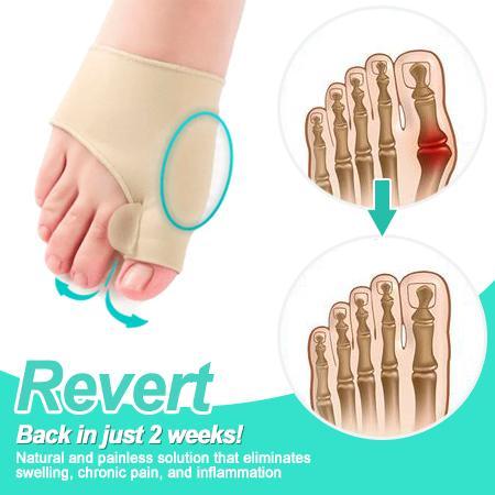 NATURFEET Bunion Corrector - Billede 2