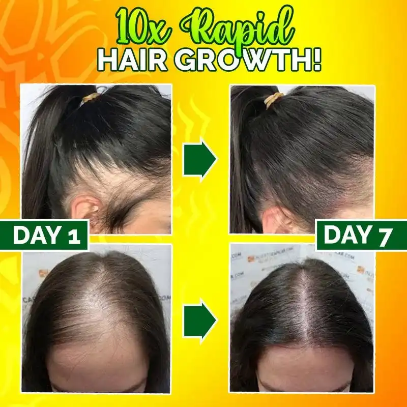 10X-Regro Strong Hair Serum - Billede 3
