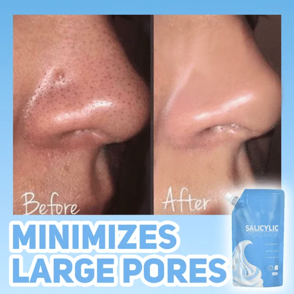 Salicylisk hydromaske - Billede 3