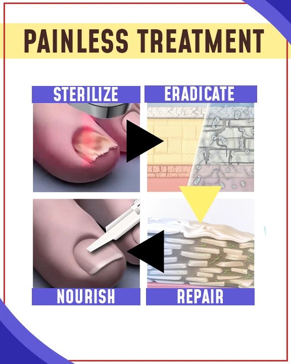 Anti-svampe behandlingssæt med blåt lys - Billede 2