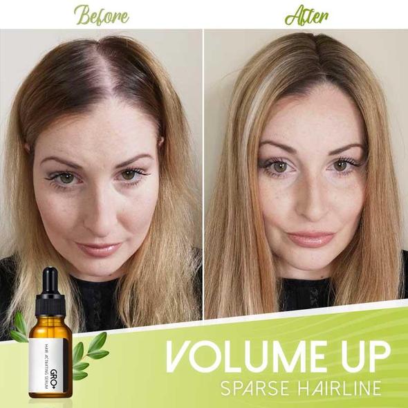 Gro+ Hair Activating Serum - Billede 4
