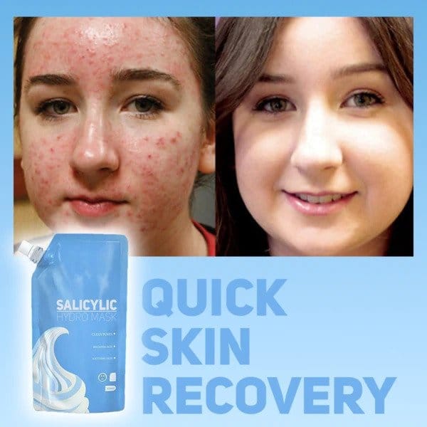 Salicylisk hydromaske - Billede 4