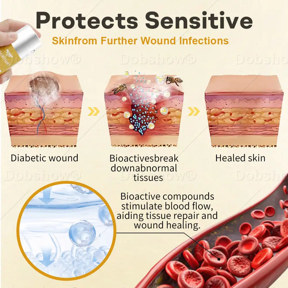 GlucoShield Bee Venom Wound Spray - Billede 3