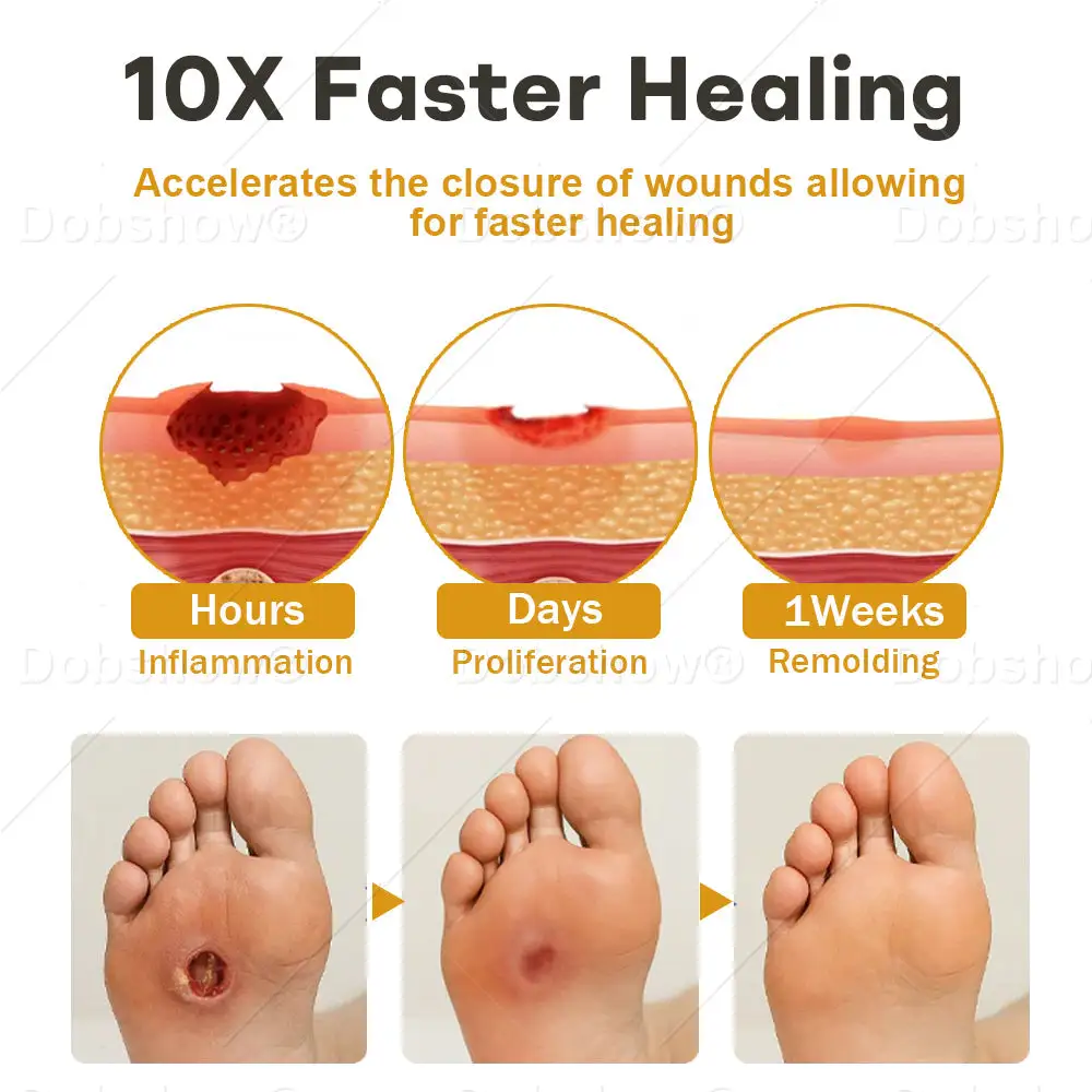 GlucoShield Bee Venom Wound Spray - Billede 4