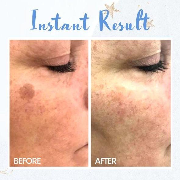 Spot Removal Pen - Billede 3