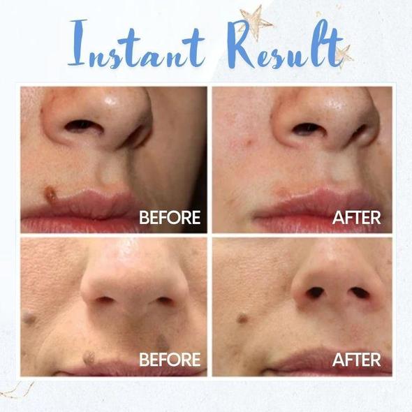 Spot Removal Pen - Billede 2