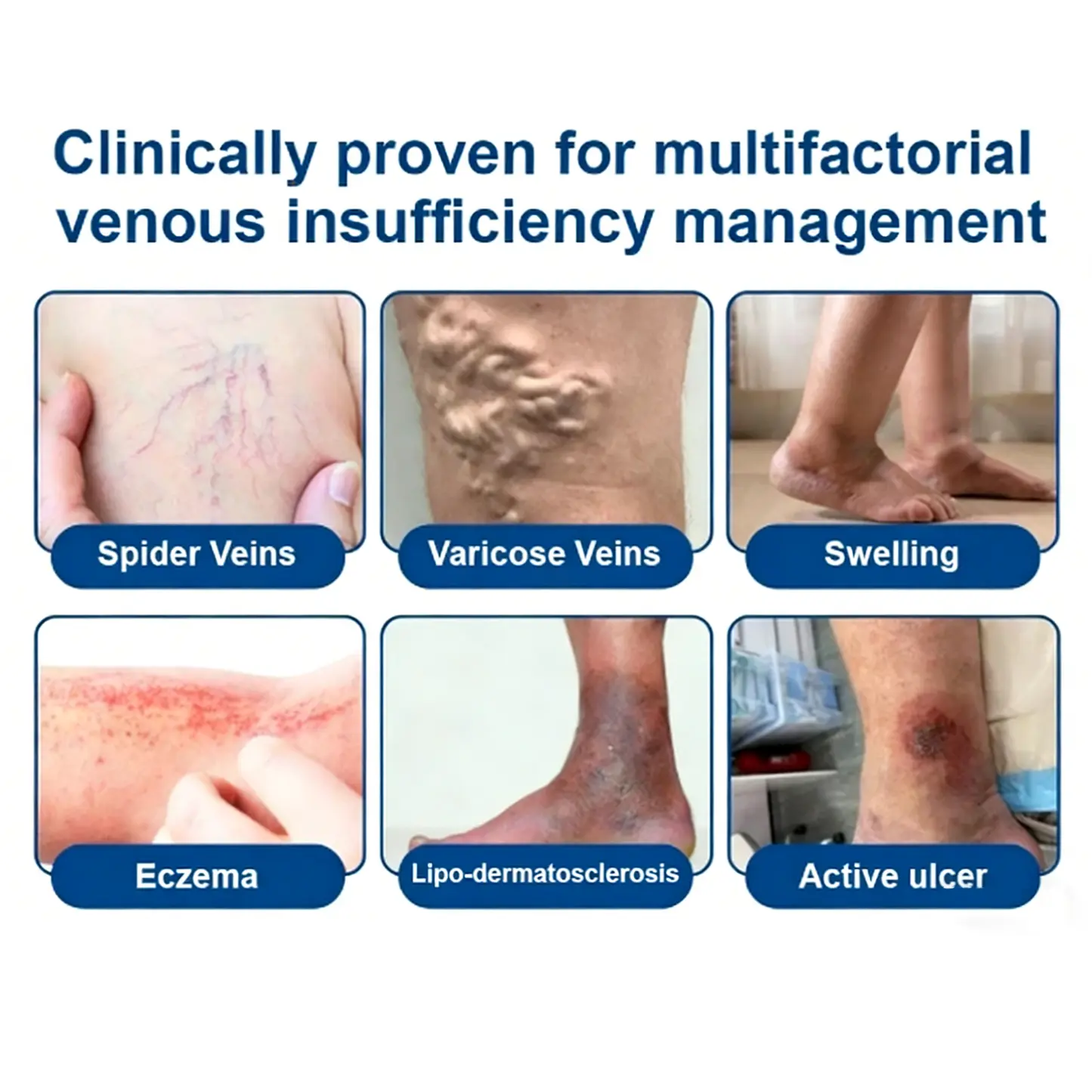 ๐ฝ๐ฒ๐ถ๐ฃ ๐พ๐จ๐ง๐๐ผ๐ช๐ง ๐๐๐๐ซ๐๐๐๐ฒ๐ฑ๐น๐๐ - Billede 3