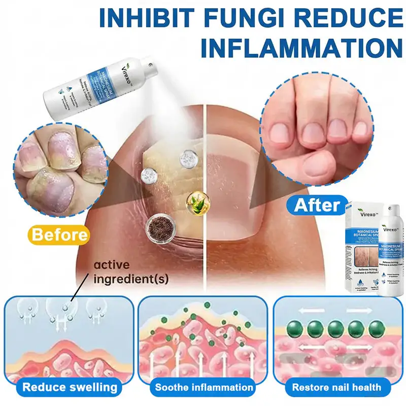 Magnesium botanisk spray - Billede 4