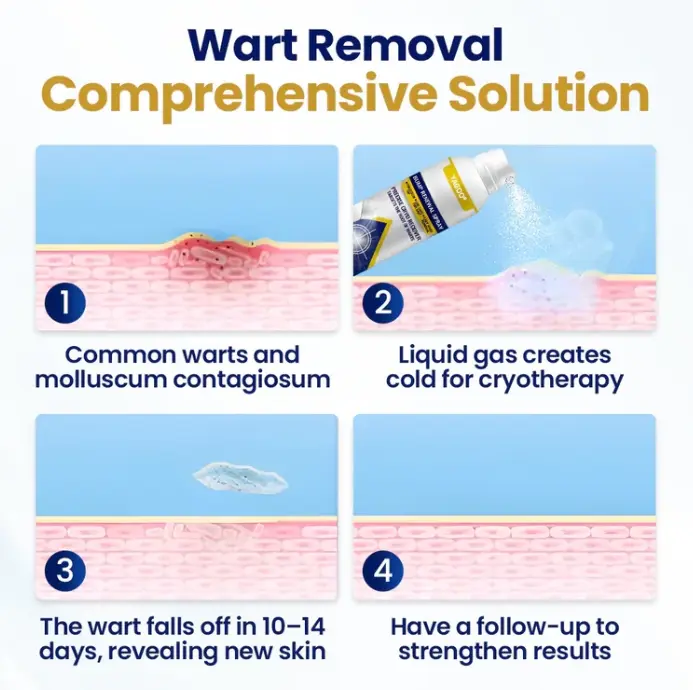 Chillique Bump Renewal Spray - Billede 3